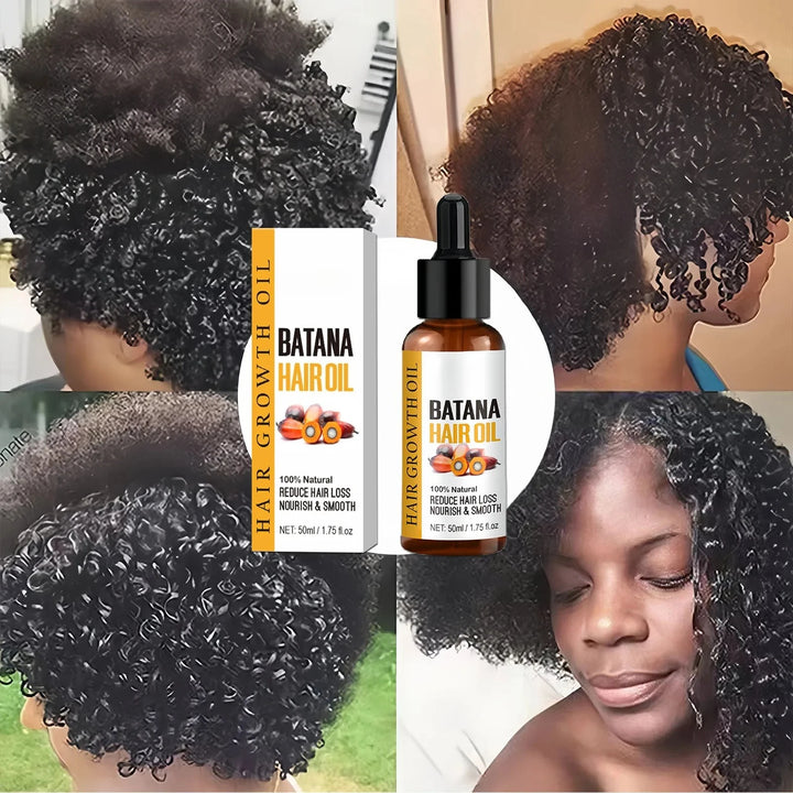 Batana Oil Hair Growth Products Fast Growth Batana Essence Oil Traction Alopecia Anti Hair Loss Baldness Treatment For Men Women