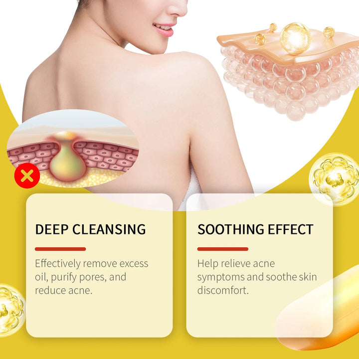 Acne Treatment Soap Pimple Remove Pigment Deep Cleansing Pores Shrink Oil Control Moisturize Body Face Lightening Skin Care Soap Halalzen