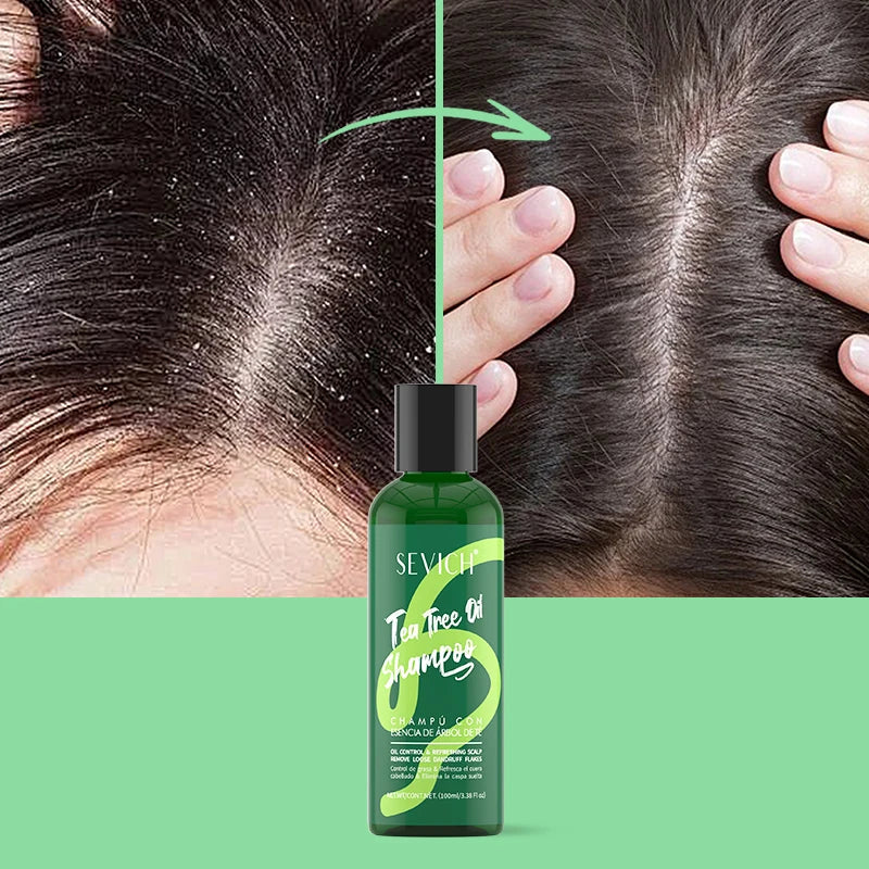 Tea Tree Essence Shampoo Hair Conditioner Set Deep Cleaning Moisturizing Scalp Strengthening Nourish Shiny Anti Hair Loss Care Halalzen