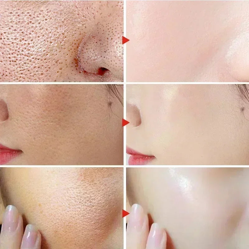 2495  Shrink Pores Serum Salicylic Fruit Acid Face Remove Blackheads Oil Control Gel Whitening Moisturizing Smooth Skin Care Pro Halalzen