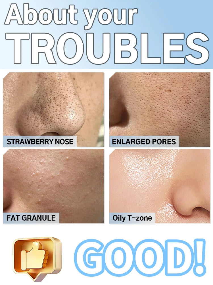 Electric Blackhead Remover Vacuum Pore Cleaner Deep Facial Cleaning Device Nose Suction Tool Skin Care Beauty Machine
