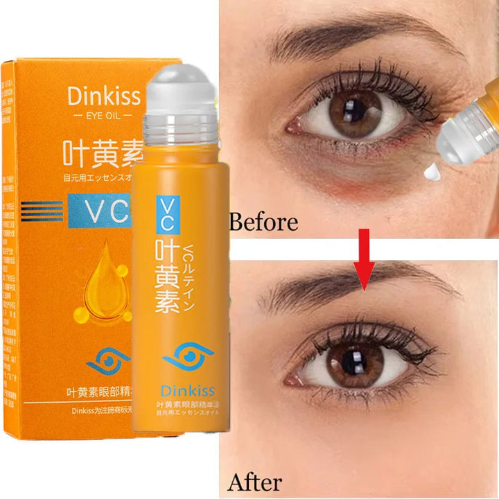 Anti Dark Circle Eye Serum Oil Retinol Anti Wrinkle Firming Skin Remove Eye Bag Fade Fine Line Whitening Brighten Eye Care Korea Halalzen