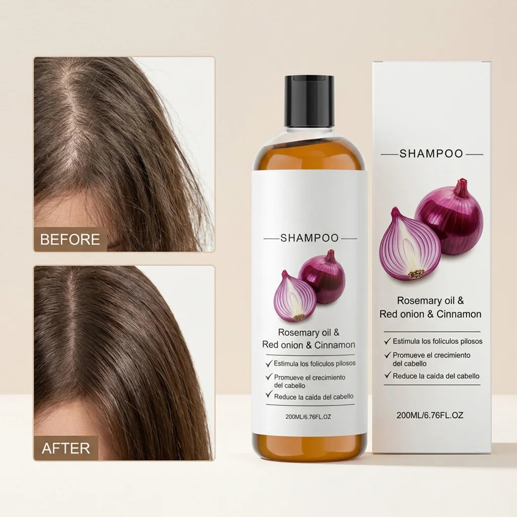 Rosemary Red Onion Shampoo Anti Hair Loss Scalp Care Hair Strengthening Volumizing Shampoo Lightweight Moisturizing Cleansing