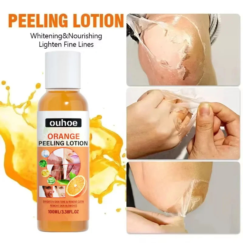 Yellow Peeling Oil Bleaching Face Body Dark Skin Brighten Whiten Lotion Hand Foot Dead Skin Peel Exfoliate Nourish New Skin Tone