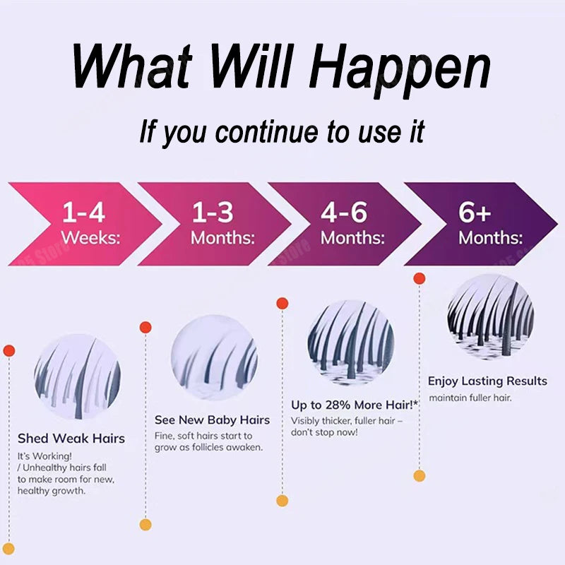 Unbelievable, replace sparse hair with thick hair Halalzen