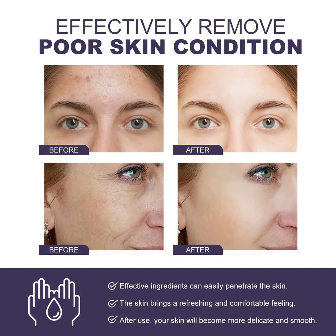 5in1 Rice Niacinamide VC Anti Aging Essence Brightening Fade Dark Spots Moisturizing Hydrating Glow Skin Care B3 Face Serum
