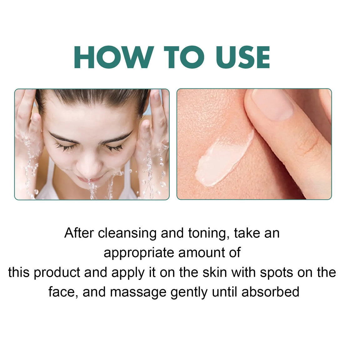 Whitening Freckle Cream Remove Acne Age Spot Melanin Sunburn Repair Anti Pigmentation Even Skin Tone Brighten Melasma Remover