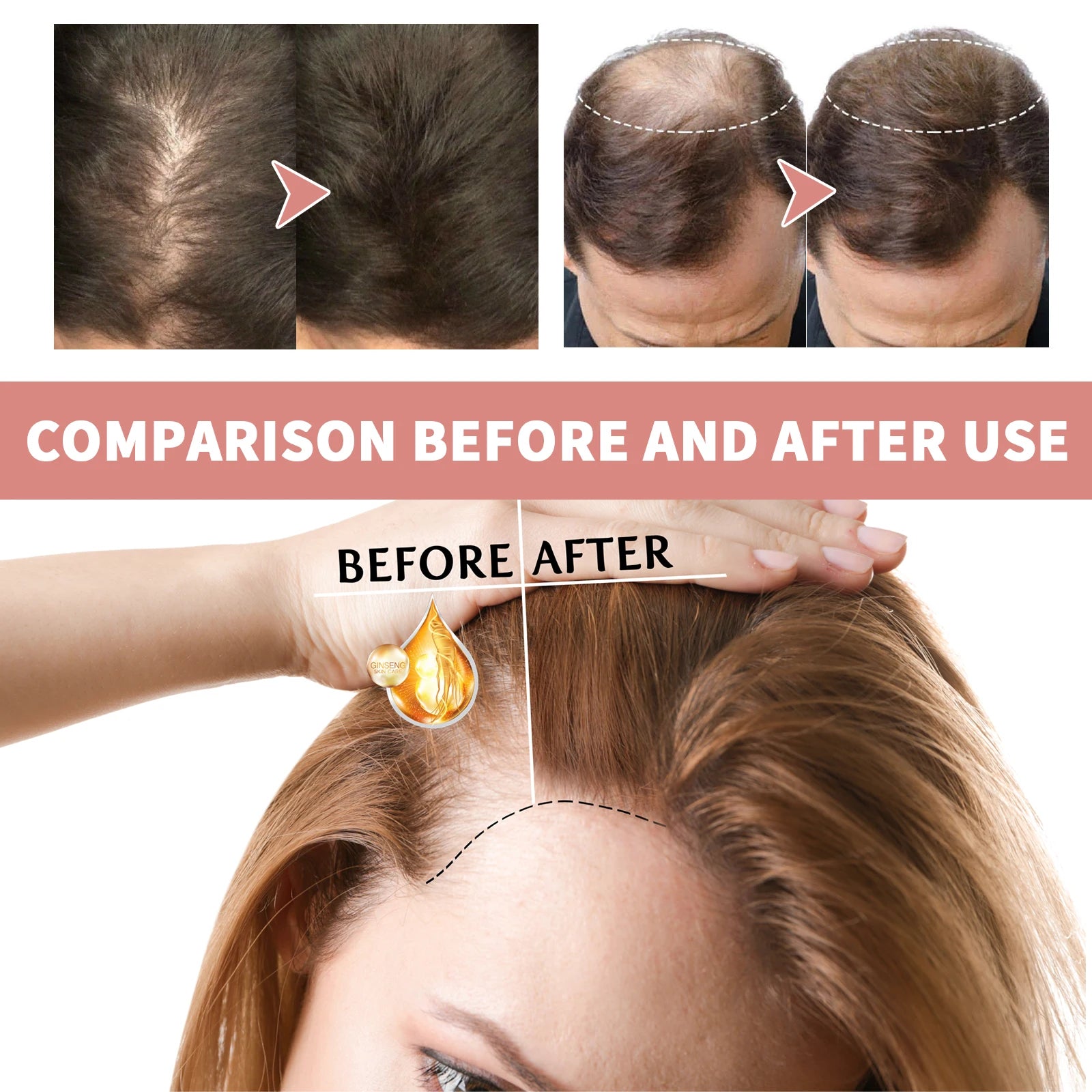 Hair Growth Ampoules Regrowth Anti Hair Loss Repair Split End Dry Damaged Hair Essential Oil Nourishing Scalp Portable Hair Care
