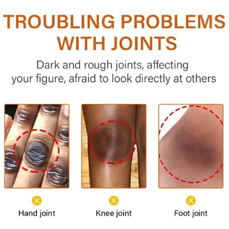 Remove Melanin Nicotinamide Brightening Cream For Dark Skin Effective Lighten Thigh Inner Bleach Private Parts Brighten 80g