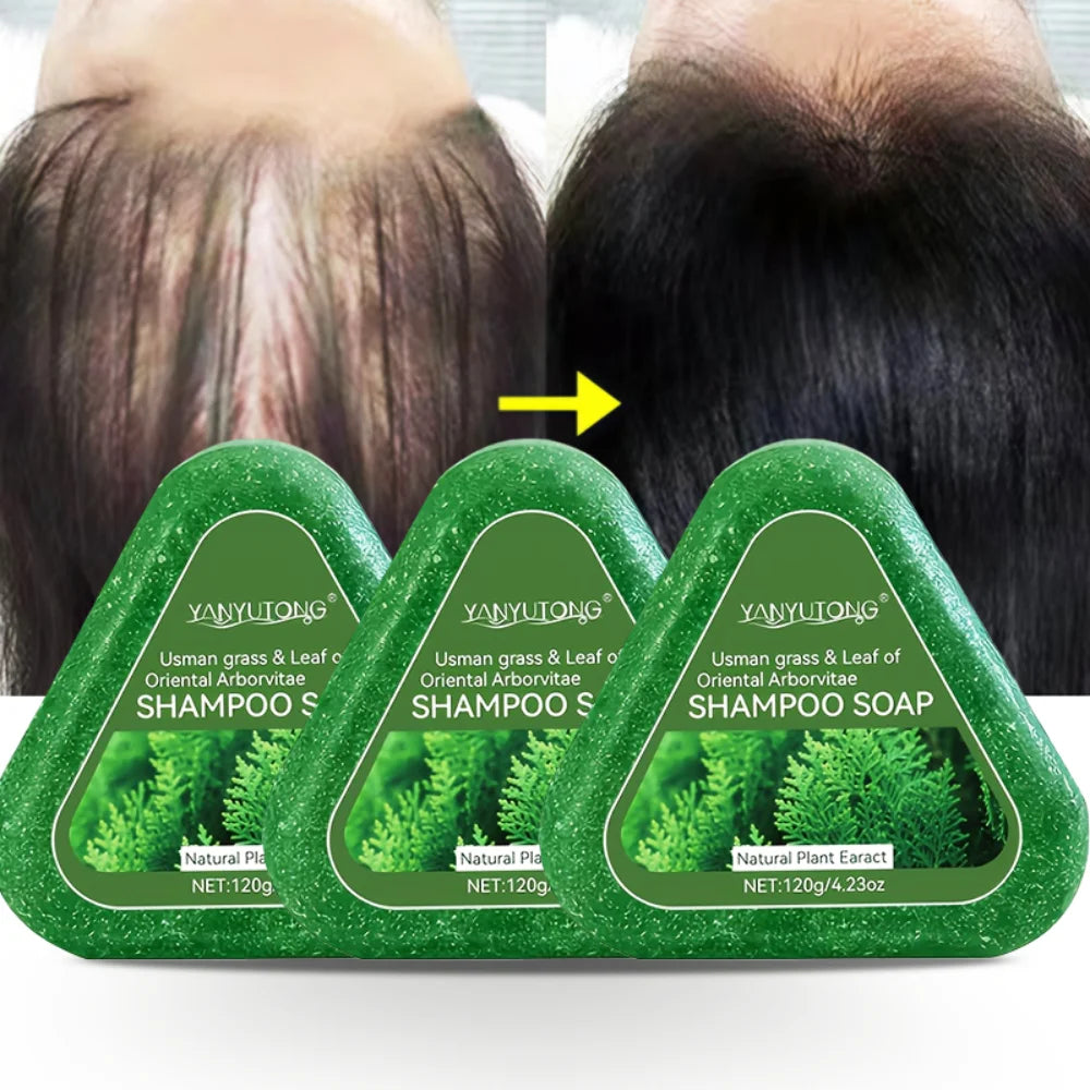 Usman Grass & Platycladus Shampoo Bar For Hair Growth Natural Herbal Soap For Hair Loss Controls Oil Strengthens Roots Shampoo