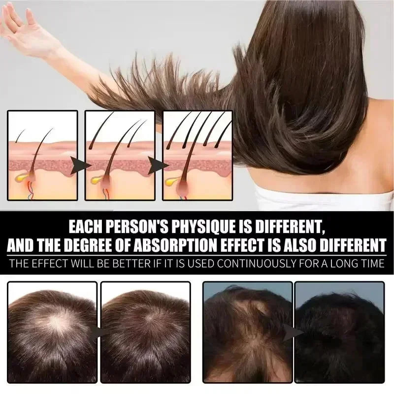 Hair Growth Serum 7 Day Fast Regrowth Essential Capsule Anti Hair loss Baldness Repair Damaged Scalp Treatment For Women Men New