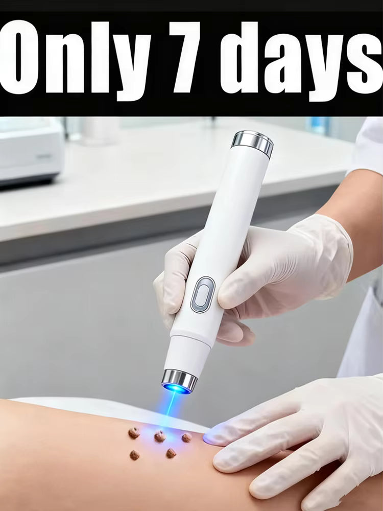 Warts Blue Light Tool, Easy To Clean Skin Care Tool Halalzen