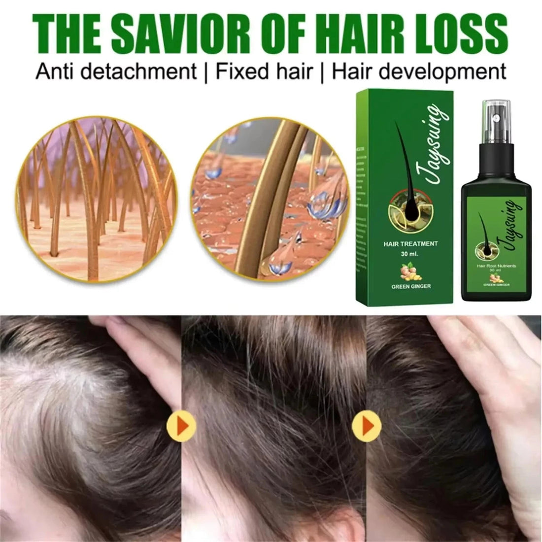 Fast Hair Growth Serum Spray Anti Hair Loss Prevent Baldness Scalp Treatment Repair Roots Beauty Health Hair Care For Men Women HALALZEN