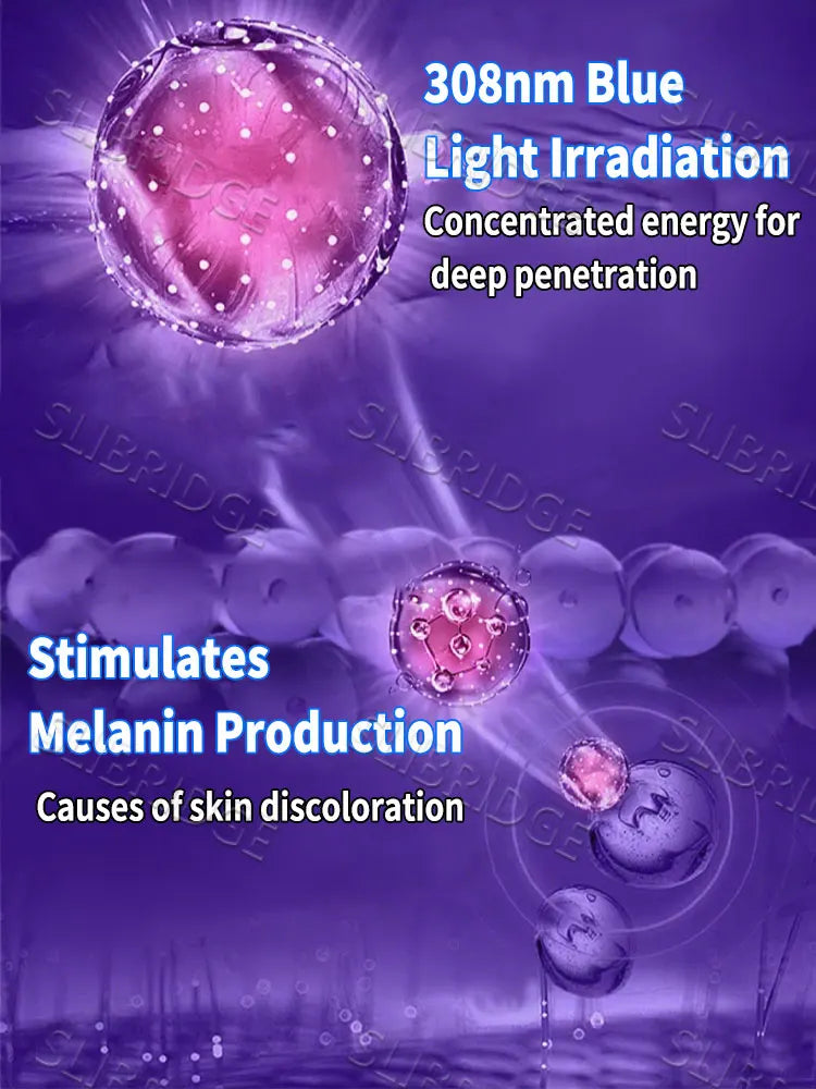 Blue light pen quickly removes vitiligo, a best-selling vitiligo care tool. Halalzen