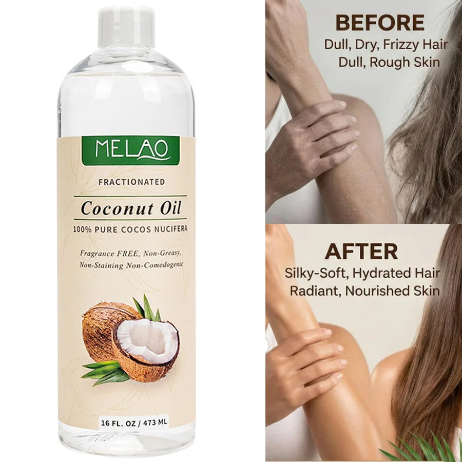 473ml Cold-Pressed Coconut Pure Essential Oil Skin Care Hair Care Soap Making DIY Making Massage Moisturize Aromatherapy
