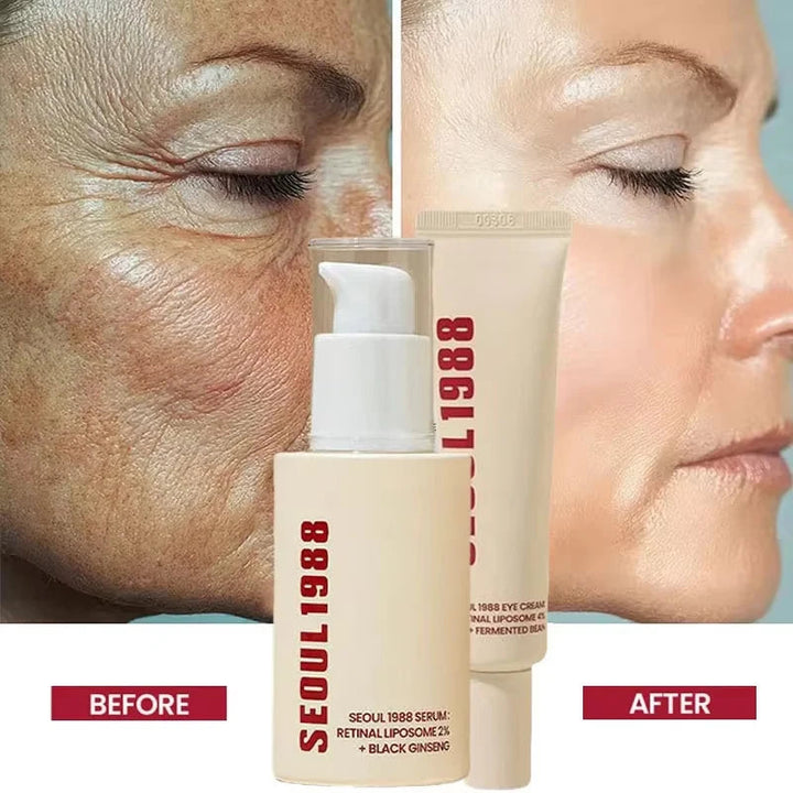 Korean 1988 Retinol Face Care Serum Black Ginseng Niacinamide 2% Acid Moisturizing Firming Cream Anti Aging Wrinkle Skin Care Halalzen