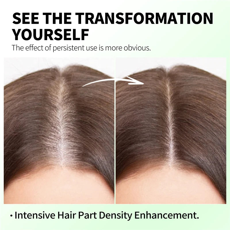 Rosemary Hair Growth Roller Essence Improves Scalp Health Stimulates Follicle Activity Reduces Hair Breakage Increases Density