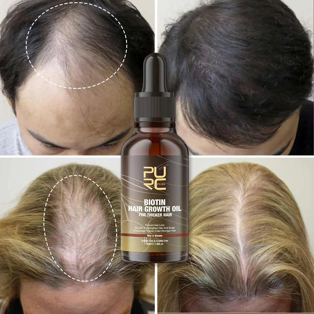 PURC Smoothing Hair Scalp Treatment Hair Shampoo Biotin Hair Oil and Conditioner Set for Men Women Hair Care Halalzen