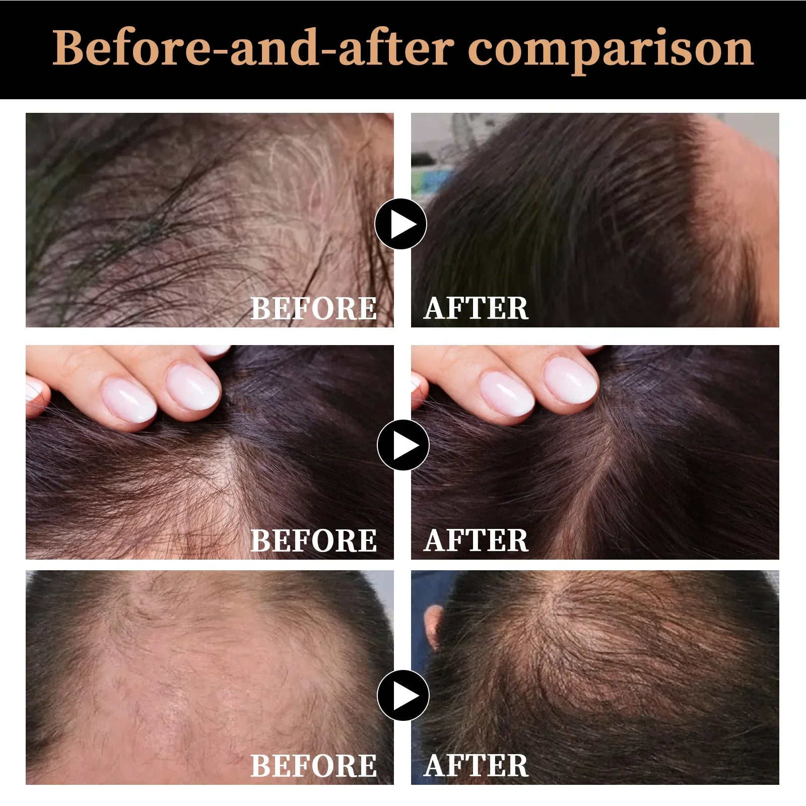 Hair Regrowth Shampoo Thickening Shampoo Root Activator Shampoo Fluffy Nourish Care For Thinning Hair Anti Hair Loss Shampoo Halalzen