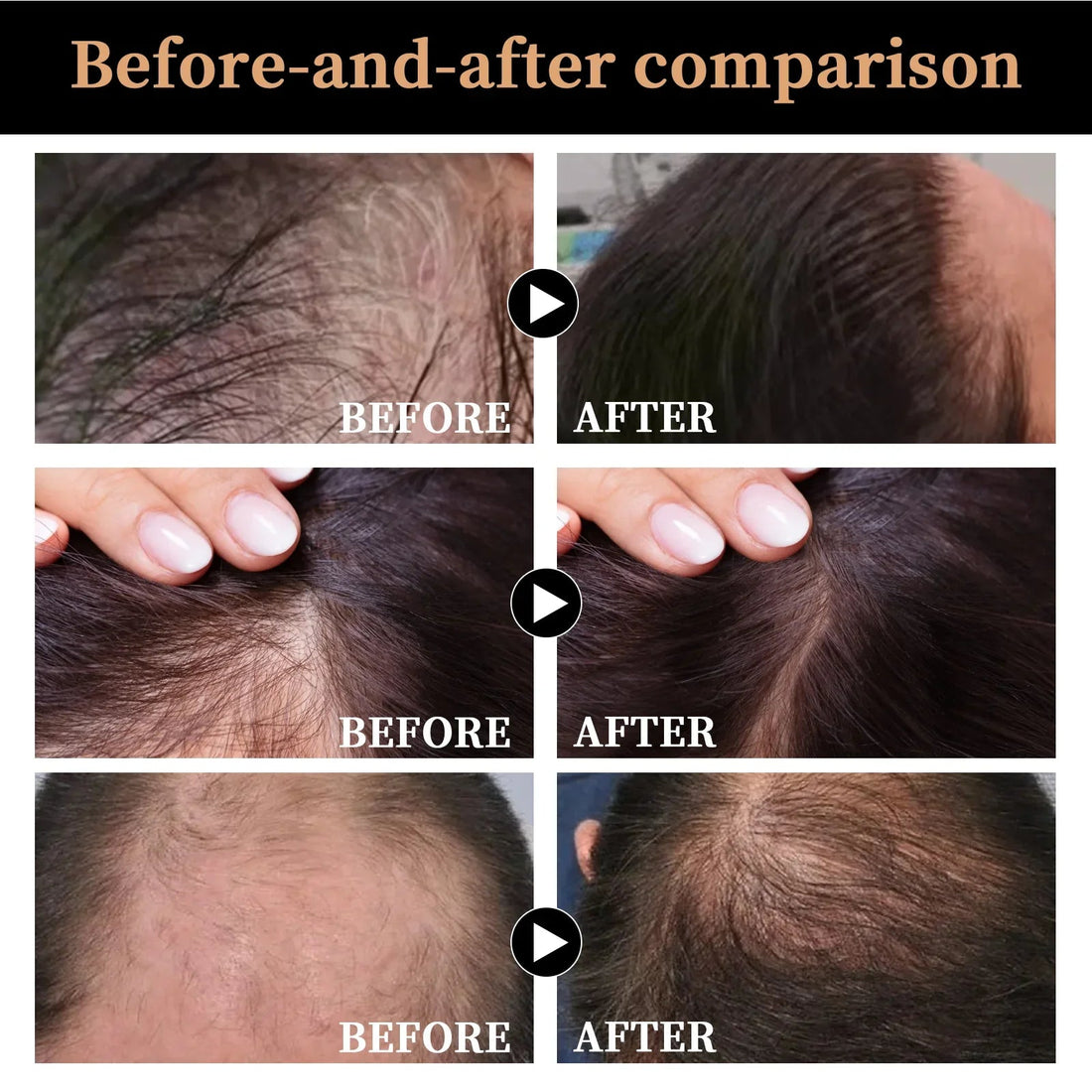 Hair Regrowth Shampoo Thickening Shampoo Root Activator Shampoo Fluffy Nourish Care For Thinning Hair Anti Hair Loss Shampoo Halalzen