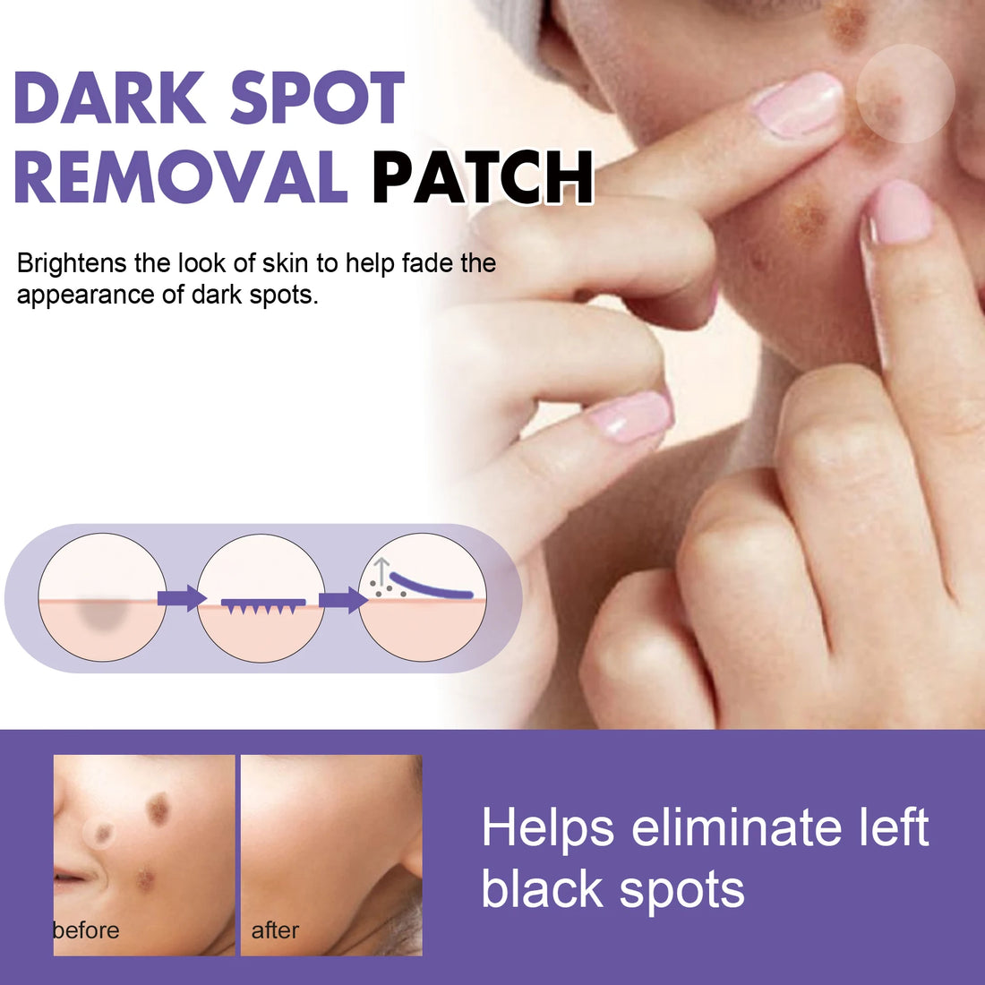 Spot-Removing Patches - For Lightening Facial Dark Spots, Chloasma, Pigmentation And Melanin; Moisturizing Skin. Spot Patches