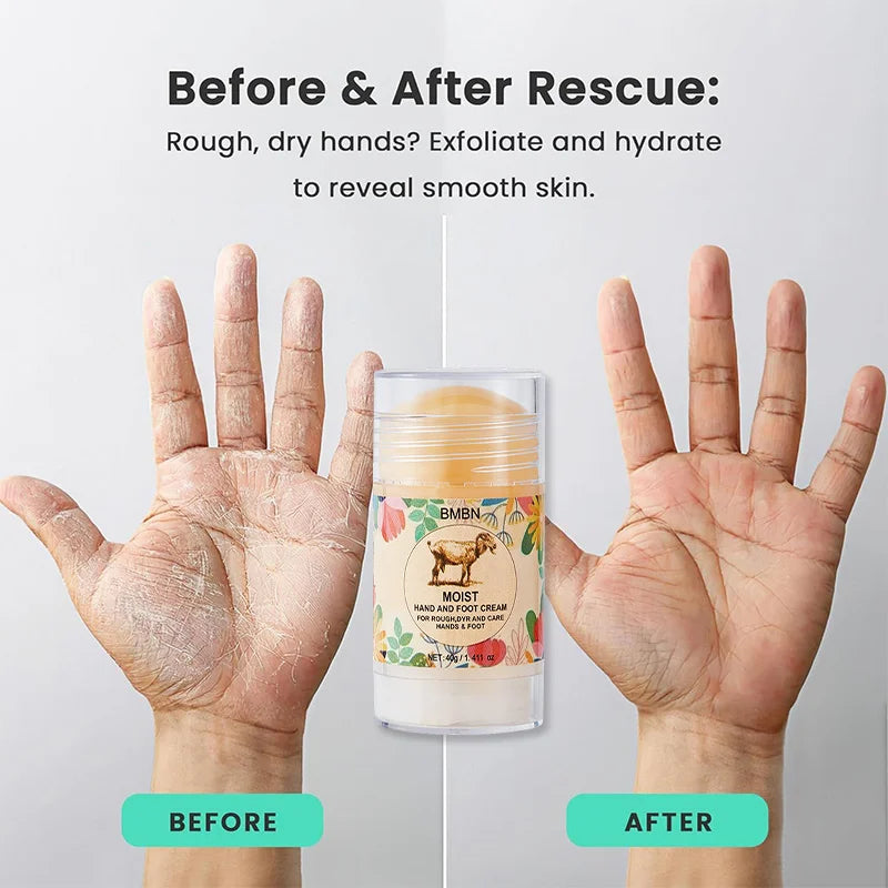 Powerful Repair Hand And Foot Cream,contains Lanolin,hyaluronic Acid, Unisex Moisturizing Cream,for Softening Dry Cracked Skin