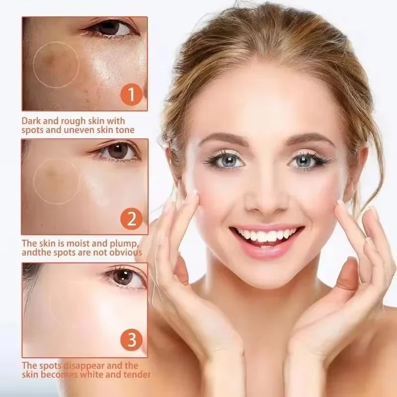 Powerful Spot-Removing Whiten Cream Brighten Skin Fast Eliminates Melanin Pigmentation Melasma Dark Spots Korean Face Skin Care