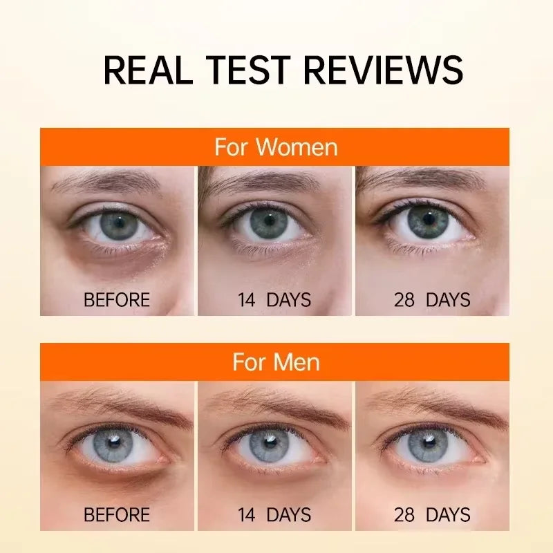 Anti Dark Circle Eye Serum Oil Retinol Anti Wrinkle Firming Skin Remove Eye Bag Fade Fine Line Whitening Brighten Eye Care Korea Halalzen