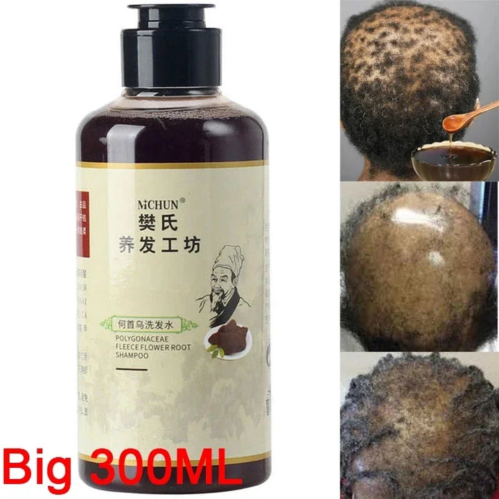 300ml Africa Women Traction Alopecia Treatment Hair Growth Product for Men Shampoo Hair Loss Treatment Get Rid of Wigs
