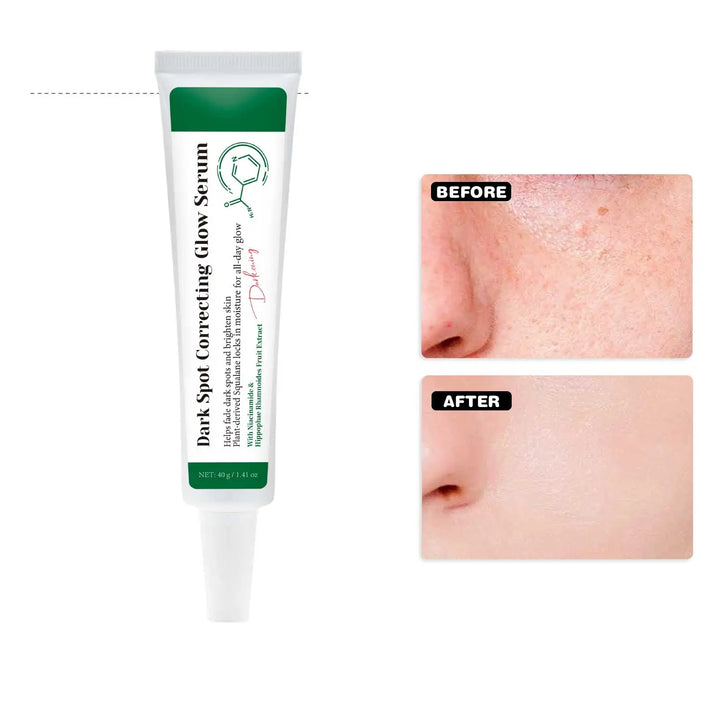 Dark Spot Correcting Glow Serum Brighten Skin Tone 5% Niacinamide Dark Spot Remover Skin Care Serum for Face 40g