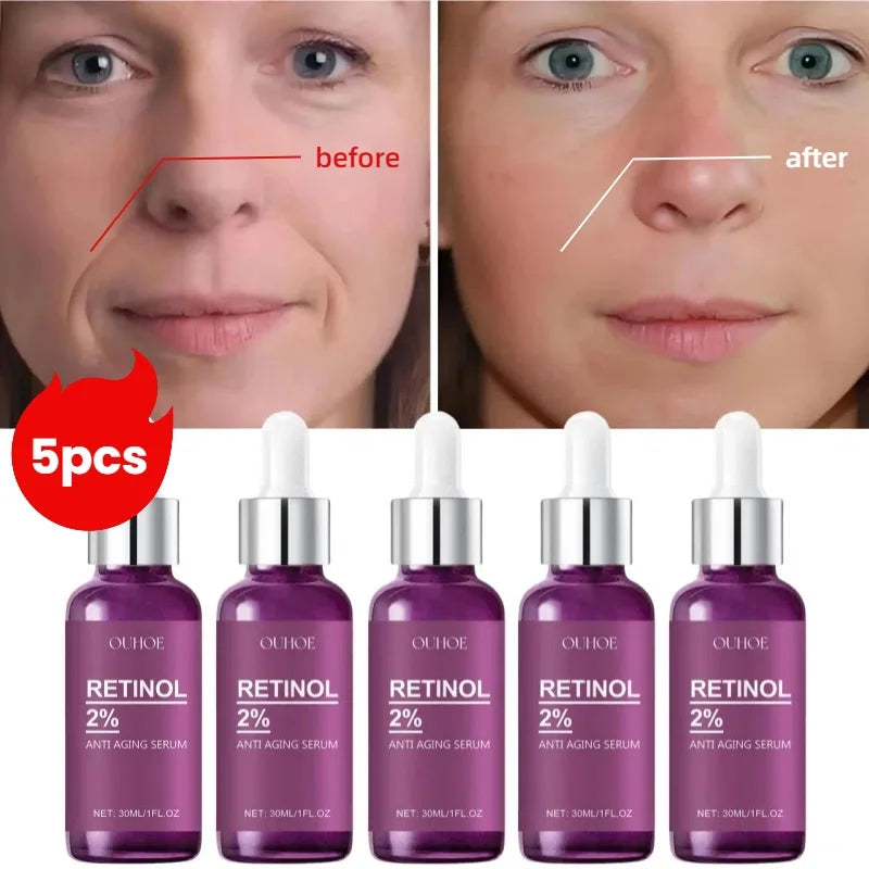 Facial Retinol Serum Whitening Moisturising Fade Fine Lines Anti Wrinkle Anti Ageing Rejuvenate Your Face Korean Cosmetics 30ml Halalzen