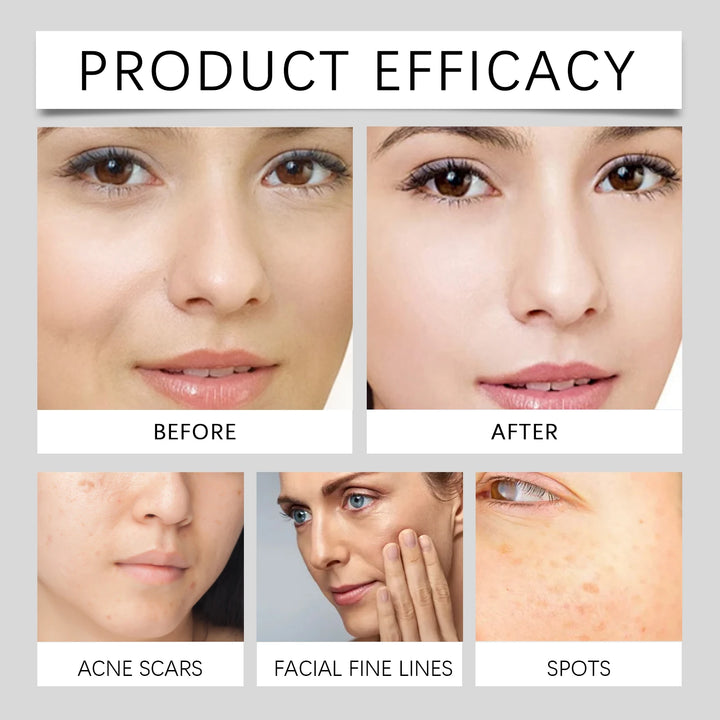 HOYGI Vitamin C Serum Cream Whiten Brightening Skin Tone Lighten Dark Spots Melasma Repair Hydrating Fast Absorbing Skin Care