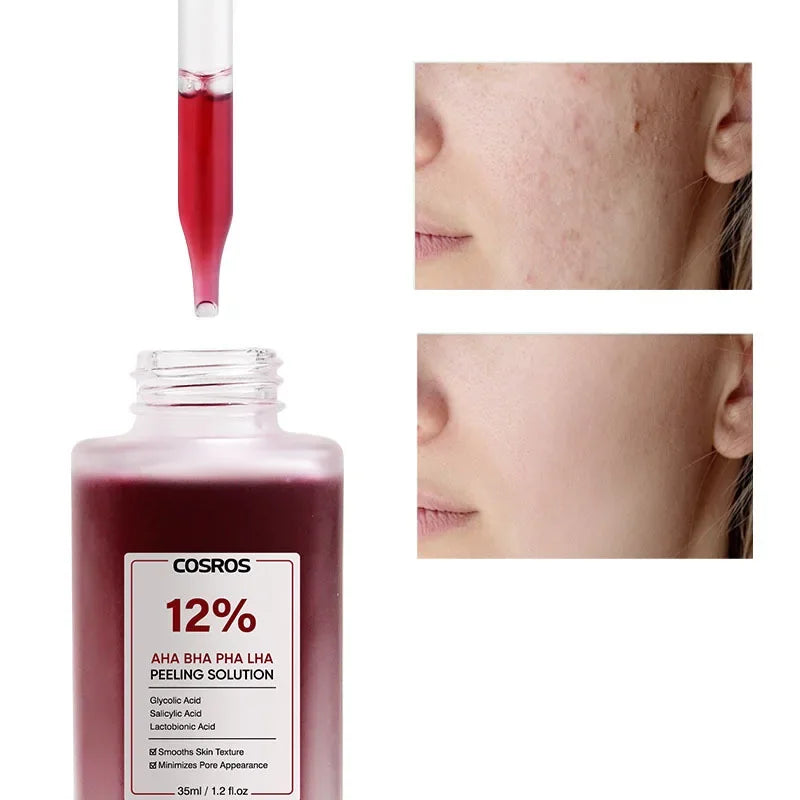 Special Fruit Acid Salicylic Acid essence Exfoliating&Shrinking Pore Moisturizing essence of TItok Hot Beauty Salon Halalzen