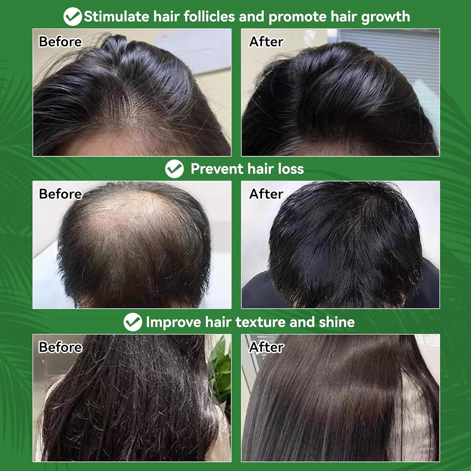 Amococo 2pcs Batana Oil 100% 150ml Each Pure Natural Hair Oil Treatment Nourishing Moisturizing Repair Care for Dry Damaged Hair Strengthening Conditioner for Women Men