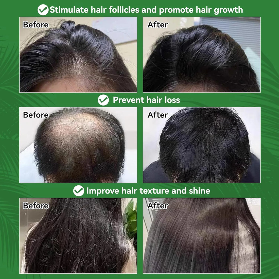 Amococo 2pcs Batana Oil 100% 150ml Each Pure Natural Hair Oil Treatment Nourishing Moisturizing Repair Care for Dry Damaged Hair Strengthening Conditioner for Women Men