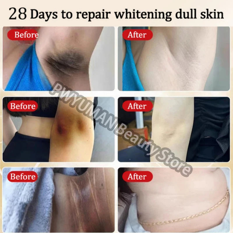 Remove Melanin Nicotinamide Brightening Cream For Dark Skin Effective Lighten Thigh Inner Bleach Private Parts Brighten Cream