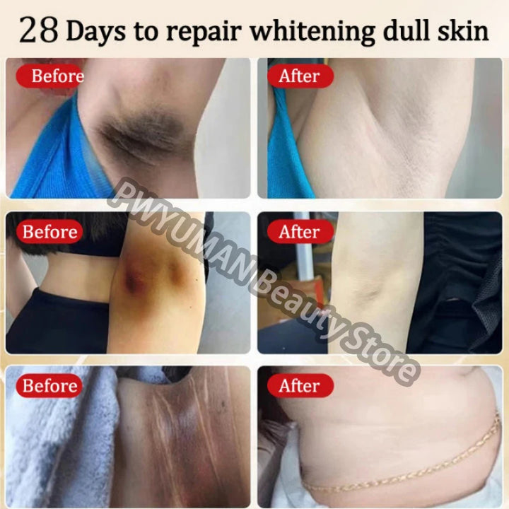 Remove Melanin Nicotinamide Brightening Cream For Dark Skin Effective Lighten Thigh Inner Bleach Private Parts Brighten Cream