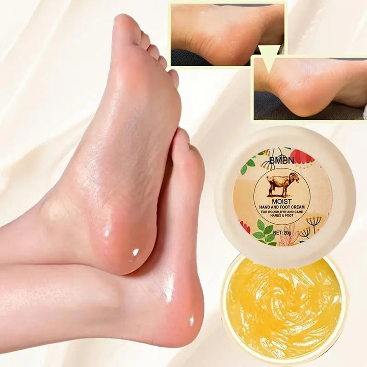 Powerful Repair Hand And Foot Cream,contains Lanolin,hyaluronic Acid, Unisex Moisturizing Cream,for Softening Dry Cracked Skin