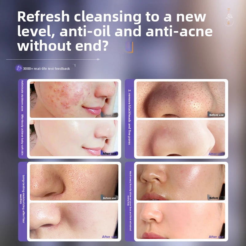 OHBT Perilla Amino Acid Facial Cleanser controls oil, removes acne, deeply cleanses, removes blackheads and shrinks pores Halalzen