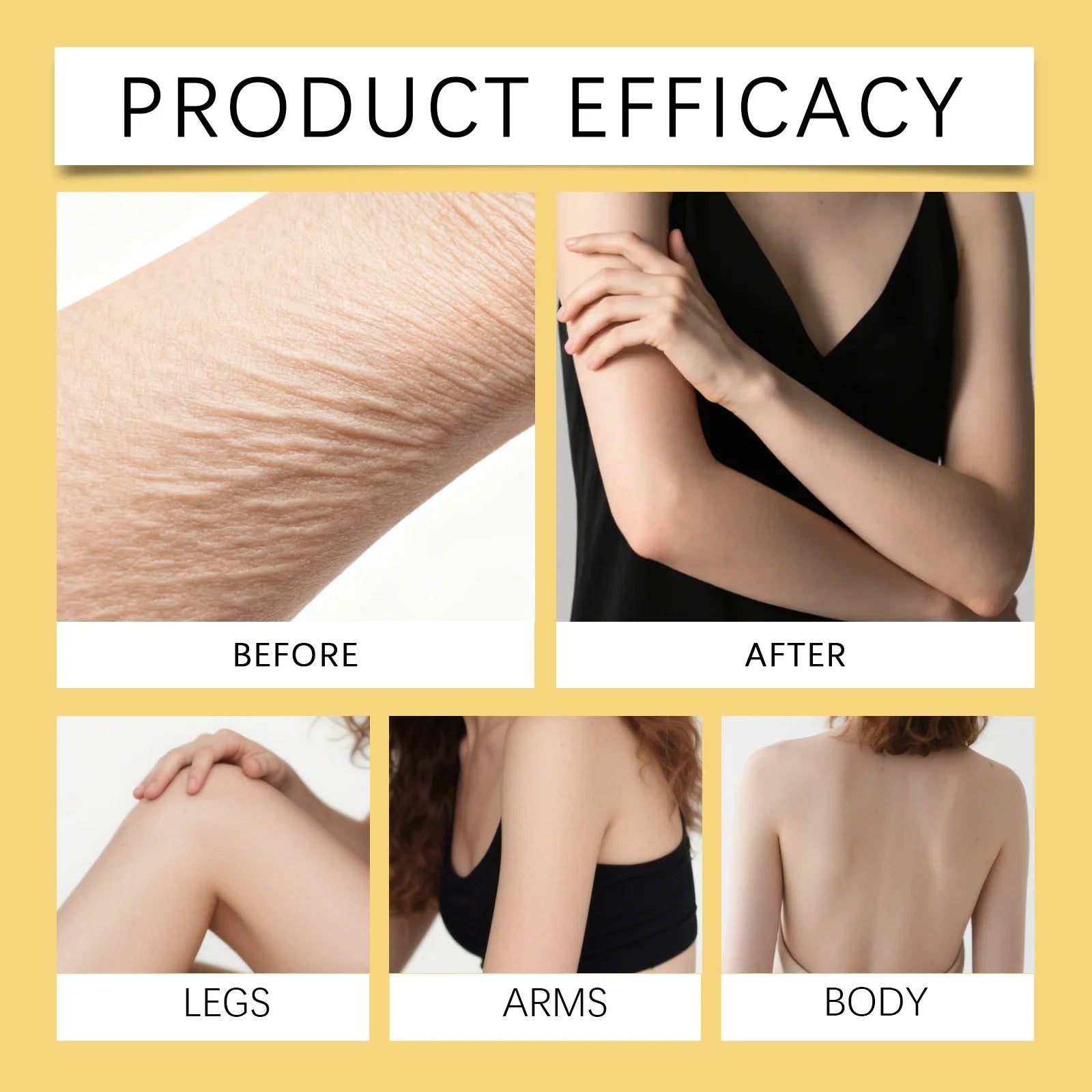 Coconut Body Oil Firming & Moisturizing Skin Care for Body Butt Chest Vitamin Enriched Dry Skin Remedy Nourishing Fast Absorbing