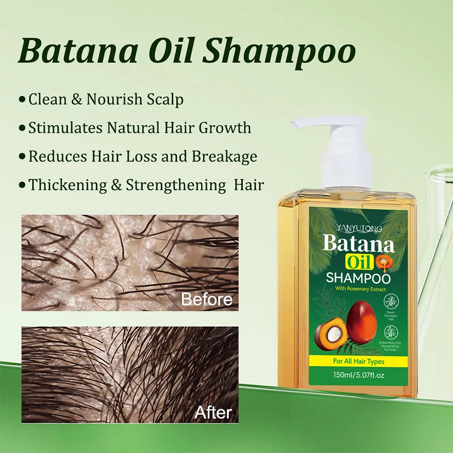 Organic Nourishing Batana Oil Shampoo & Conditioner Set for Damaged Hair, Strengthens, Prevents Hair Loss, and Controls Dandruff