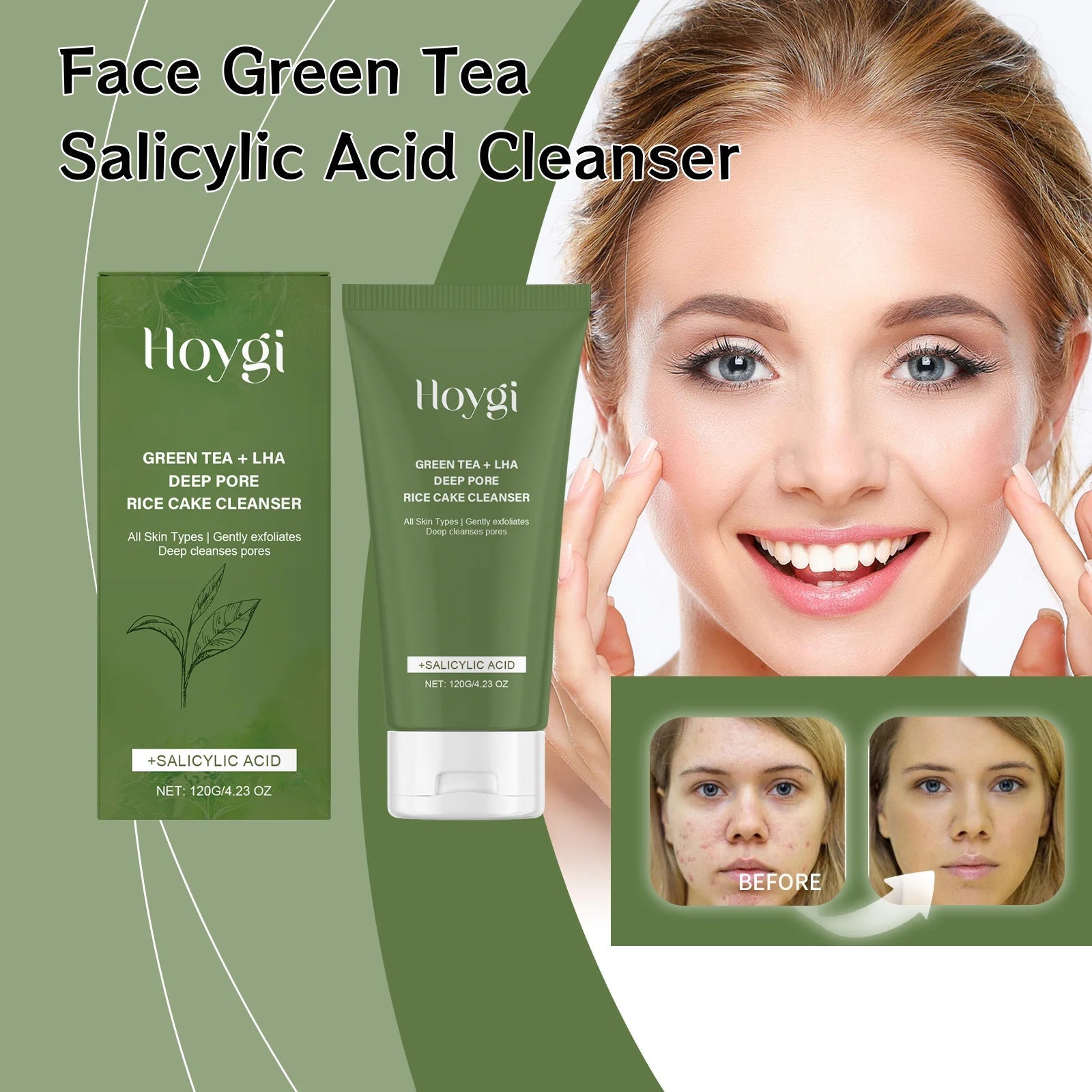Green Tea Salicylic Acid Facial Cleanser Gently Clean Pores Moisturize Without Tightening Improve Acne Cleanse Refresh Care Halalzen