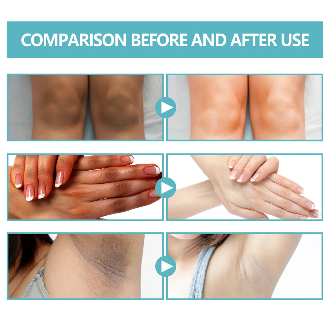 Whitening Cream Brightening Skin for Dark Skin Lightening Neck Arm Knee Joint Underarm Elbow Moisturizing Body Care Products