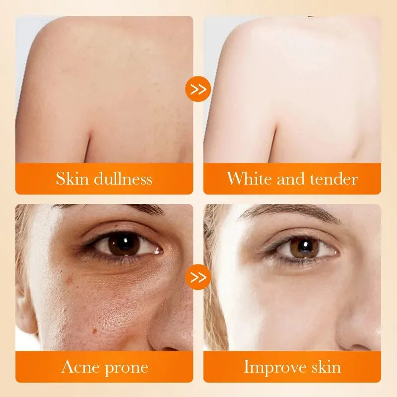 Sadoer Kojic Acid Facial Soap Face Wash Foam Facial Cleanser Moisturizing Hydrating Oil Control Body Bathing Handmade Soap Halalzen
