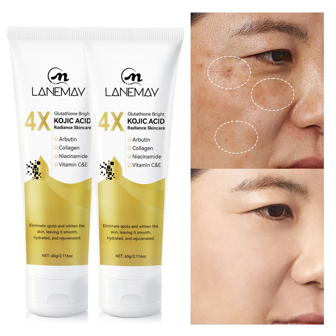 4X Glutathione Bright Kojic Acid Radiance Skincare - Eliminates Spots, Evens Tone, Smooths & Hydrates, 60g