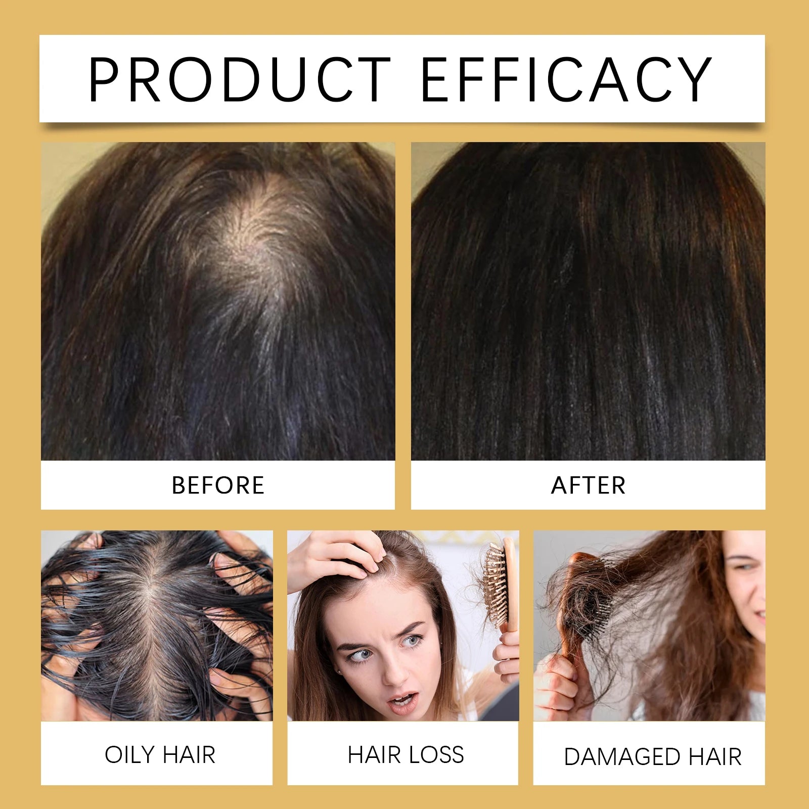 Ginger Shampoo Soap Deep Nourish Repairing Damaged Hair Roots Reduce Hair Loss Clean Dandruff Scalp Hair Shampoo Bar Hair Care Halalzen
