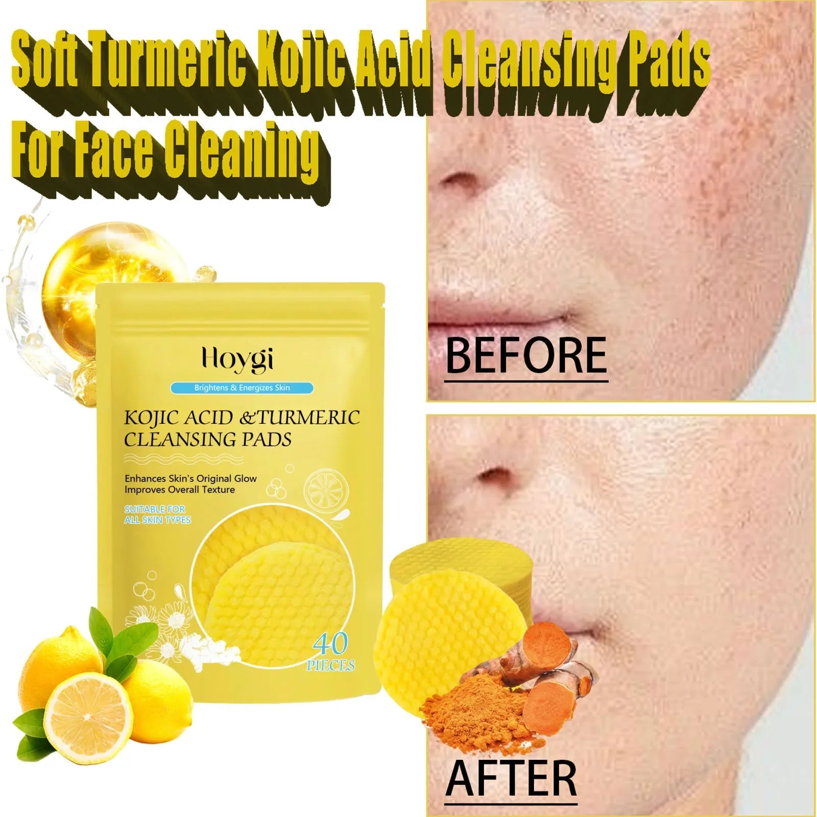 Turmeric Kojic Acid Cleansing Pads Exfoliating Pads Facial Sponges For Cleansing Exfoliating Daily Cleansing Skin Care Tools Halalzen