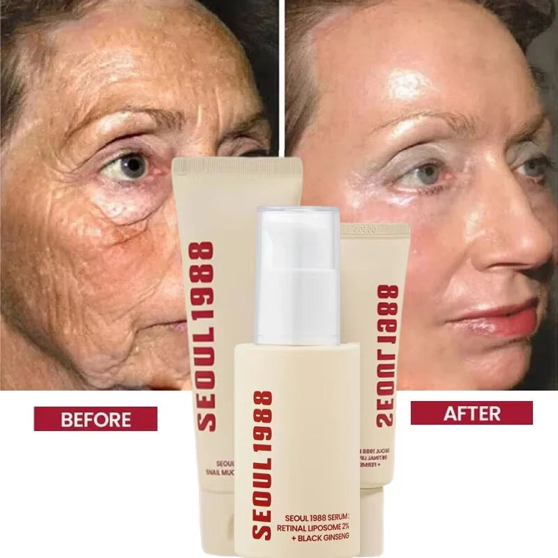 Korean 1988 Retinol Face Care Serum Black Ginseng Niacinamide 2% Acid Moisturizing Firming Cream Anti Aging Wrinkle Skin Care Halalzen
