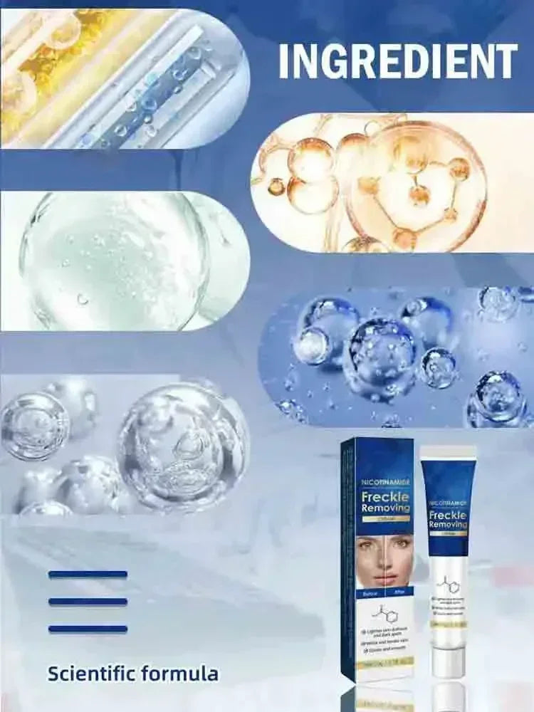 Dark Spot Remover for Face Removing Freckle target hyperpigmentation  age spots sun spot Whitening MOISTURIZING skin beauty care