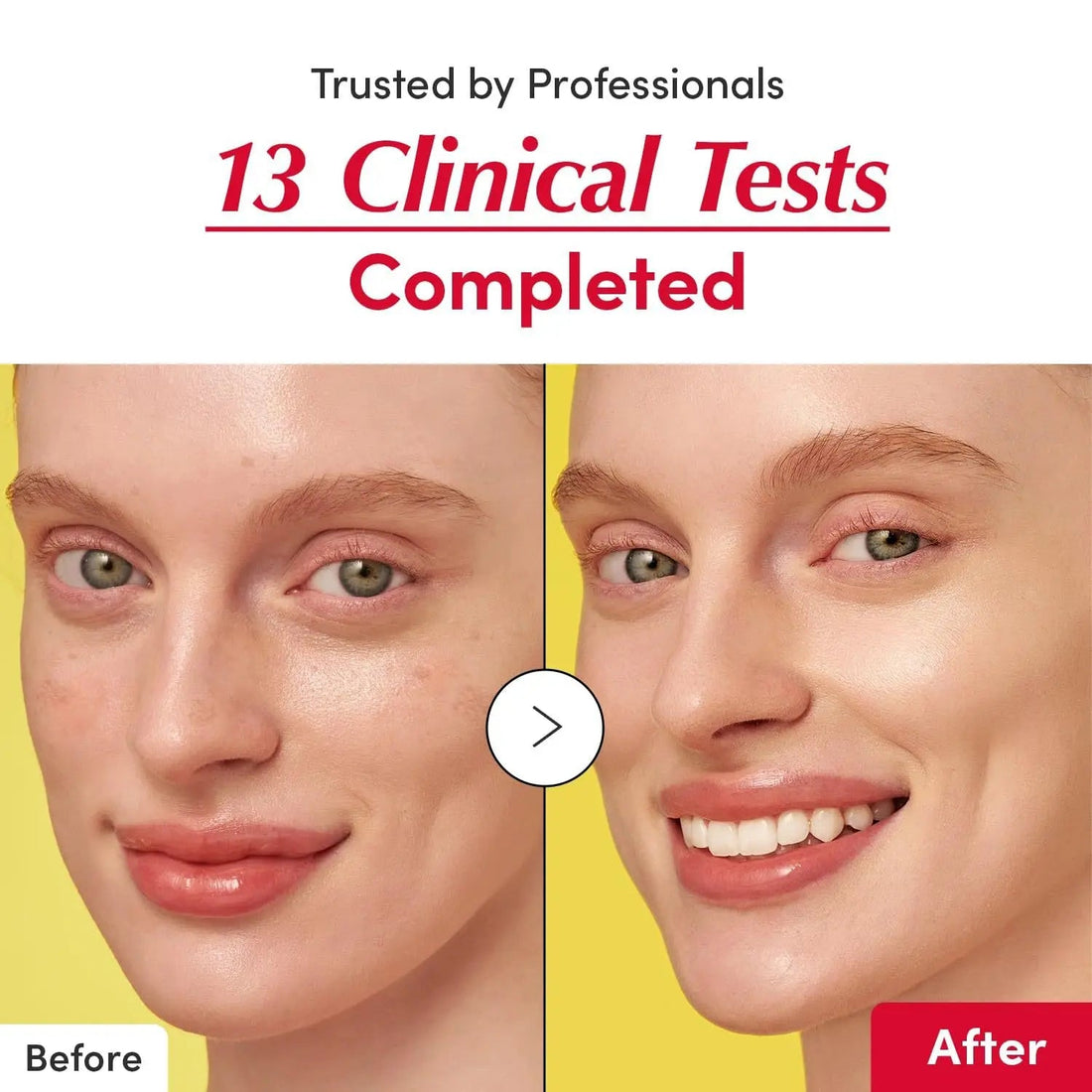 Bakuchiol & Vitamin C Serum Anti-Aging &Brightening Duo for Radiant, Firm Skin Gentle Retinol Alternative Vitamin Glow Enhancer Halalzen